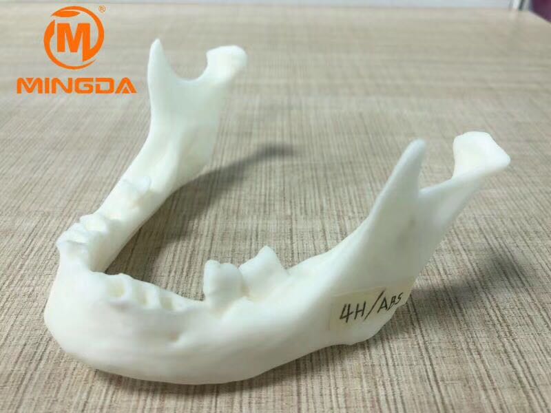 工業級3D打印機在牙科行業的應用(圖1) 工業級3D打印機在牙科行業的應用(圖1)