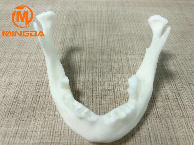 工業級3D打印機在牙科行業的應用(圖2) 工業級3D打印機在牙科行業的應用(圖2)